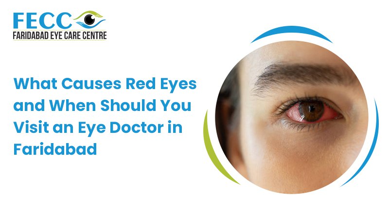 What Causes Red Eyes and When Should You Visit an Eye Doctor in Faridabad